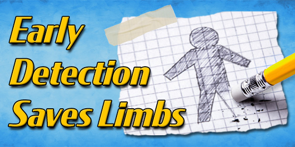 Early Detection Saves Limbs